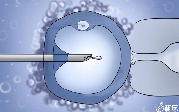   盐城地区人类辅助生殖技术应用现状分析