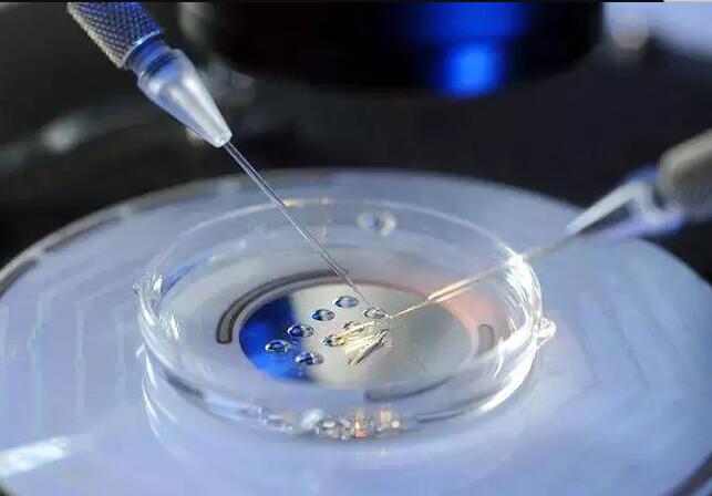   盆腔积液与不孕症的关系