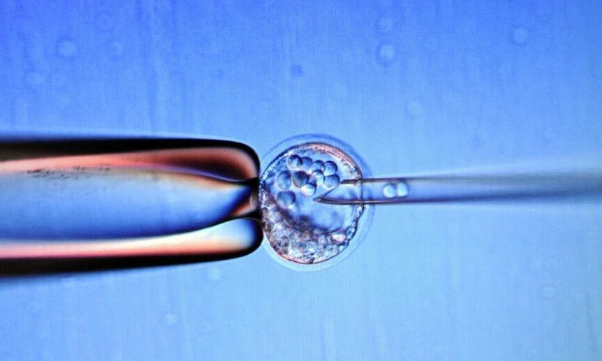   福州不孕不育医院辅助生殖技术现状分析