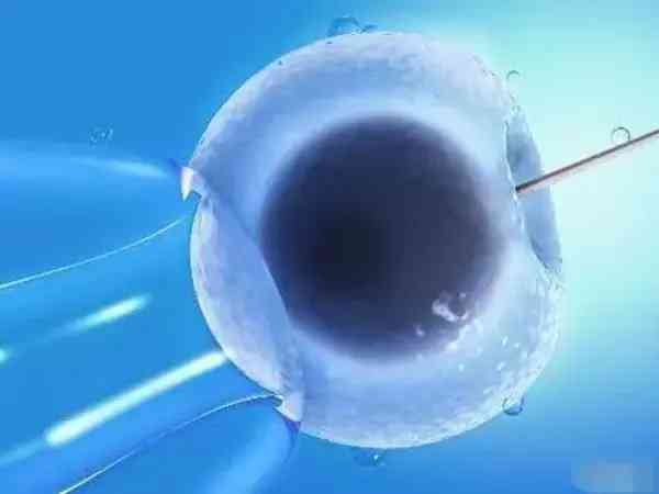   男性不育症的微创治疗技术