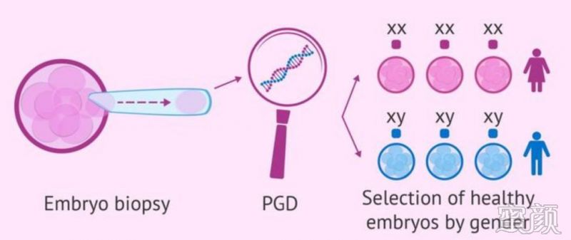   男性不育症的病因学和治疗策略