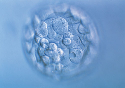   白细胞升高机制与病因分析